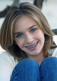 girl with braces